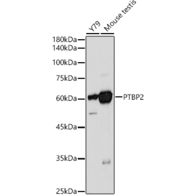 Western Blot - Anti-PTBP2 Antibody (A15069) - Antibodies.com