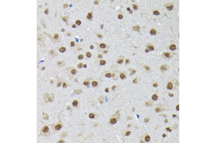 Immunohistochemistry - Anti-PTBP2 Antibody (A15069) - Antibodies.com