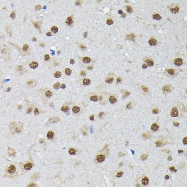 Immunohistochemistry - Anti-PTBP2 Antibody (A15069) - Antibodies.com