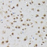 Immunohistochemistry - Anti-PTBP2 Antibody (A15069) - Antibodies.com