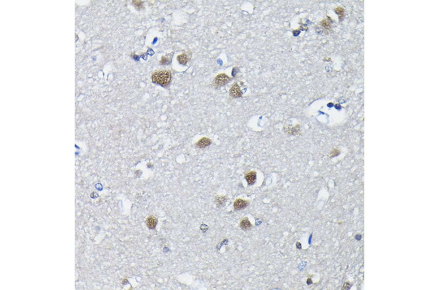 Immunohistochemistry - Anti-PTBP2 Antibody (A15069) - Antibodies.com