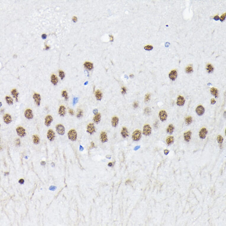 Immunohistochemistry - Anti-PTBP2 Antibody (A15069) - Antibodies.com