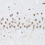 Immunohistochemistry - Anti-PTBP2 Antibody (A15069) - Antibodies.com