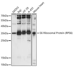 Western Blot - Anti-RPS6 Antibody (A15070) - Antibodies.com