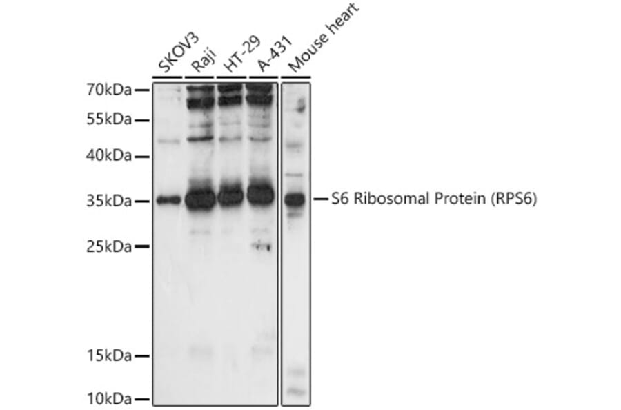 Western Blot - Anti-RPS6 Antibody (A15070) - Antibodies.com