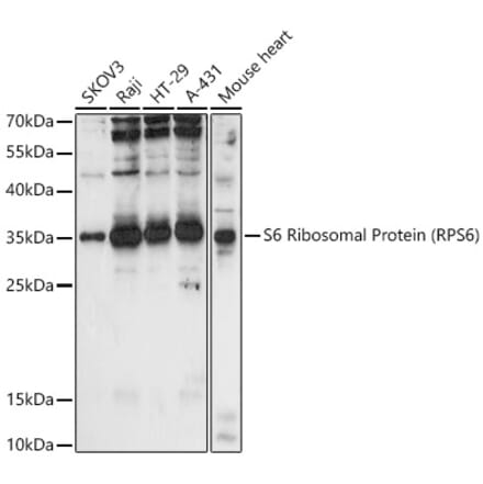 Western Blot - Anti-RPS6 Antibody (A15070) - Antibodies.com