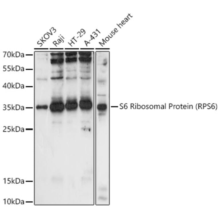 Western Blot - Anti-RPS6 Antibody (A15070) - Antibodies.com