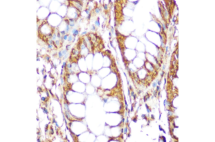 Immunohistochemistry - Anti-RPS6 Antibody (A15070) - Antibodies.com