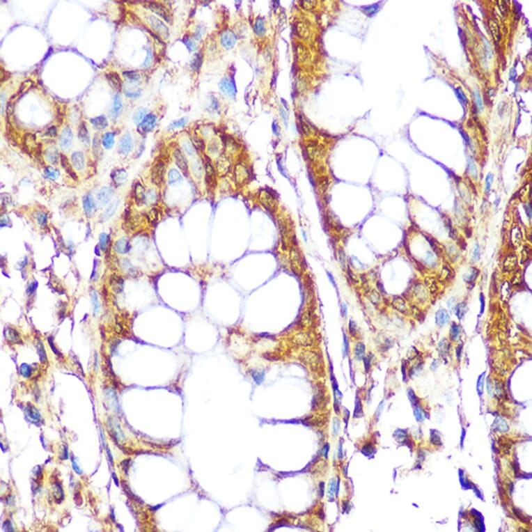 Immunohistochemistry - Anti-RPS6 Antibody (A15070) - Antibodies.com