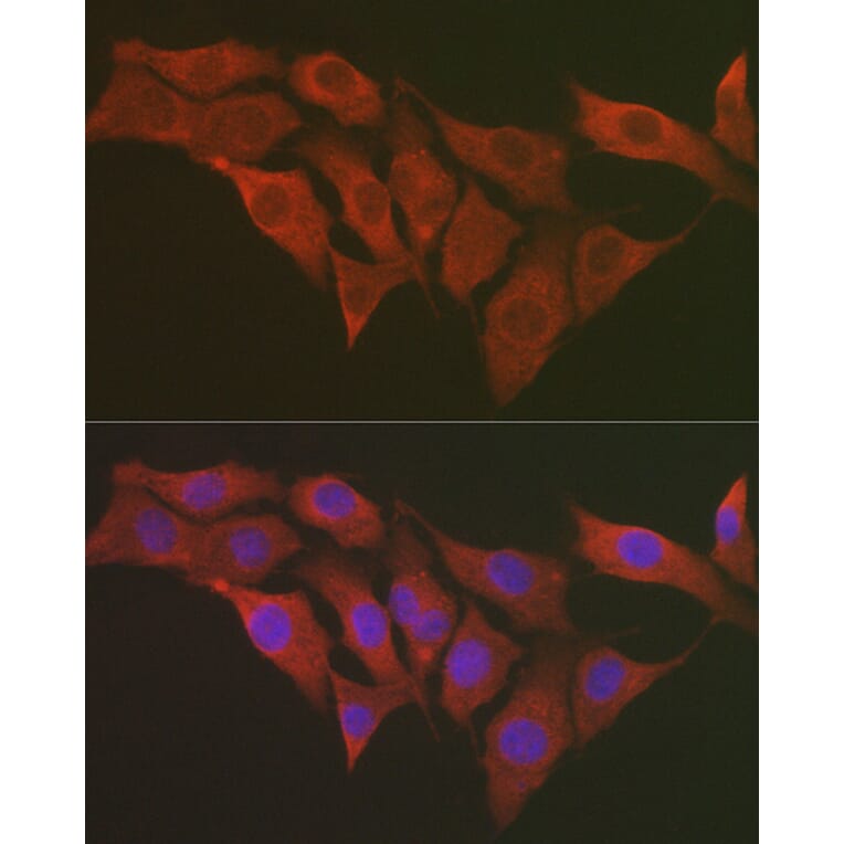 Immunofluorescence - Anti-RPS6 Antibody (A15070) - Antibodies.com