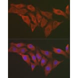Immunofluorescence - Anti-RPS6 Antibody (A15070) - Antibodies.com