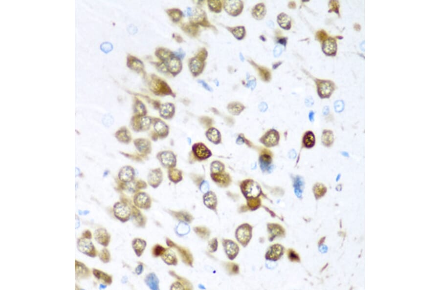Immunohistochemistry - Anti-ELAVL3 Antibody (A15071) - Antibodies.com