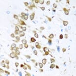 Immunohistochemistry - Anti-ELAVL3 Antibody (A15071) - Antibodies.com