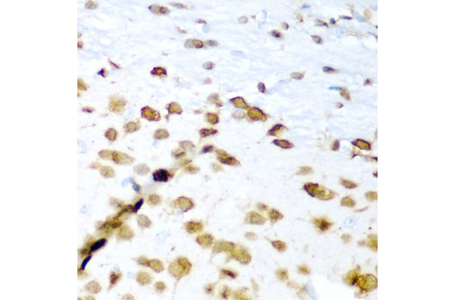 Immunohistochemistry - Anti-ELAVL3 Antibody (A15071) - Antibodies.com