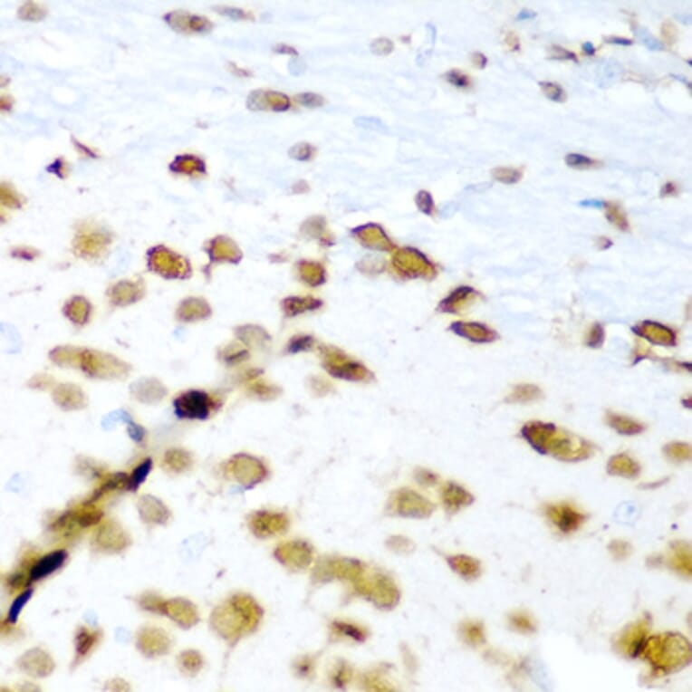 Immunohistochemistry - Anti-ELAVL3 Antibody (A15071) - Antibodies.com