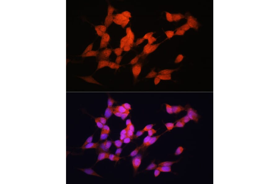 Immunofluorescence - Anti-ELAVL3 Antibody (A15071) - Antibodies.com