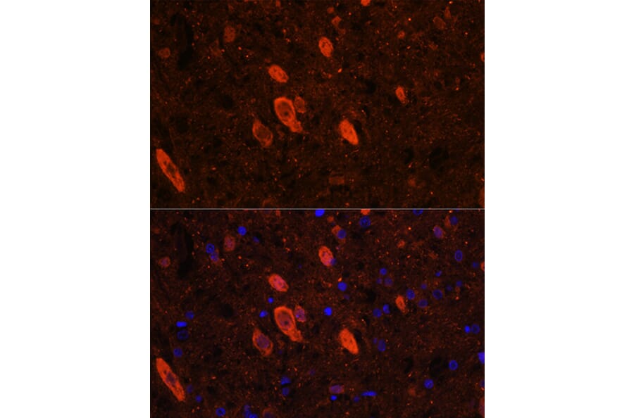 Immunofluorescence - Anti-ELAVL3 Antibody (A15071) - Antibodies.com