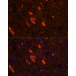 Immunofluorescence - Anti-ELAVL3 Antibody (A15071) - Antibodies.com