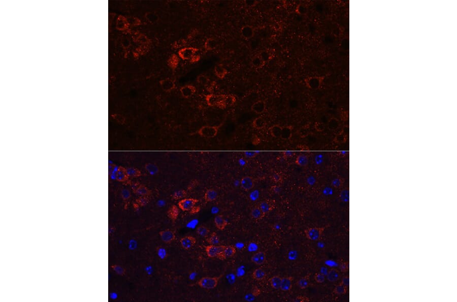 Immunofluorescence - Anti-ELAVL3 Antibody (A15071) - Antibodies.com