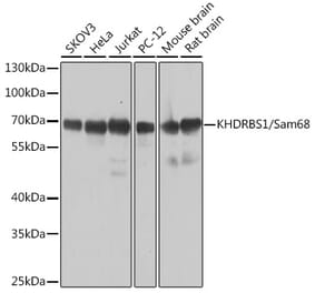 Western Blot - Anti-SAM68 Antibody (A15072) - Antibodies.com