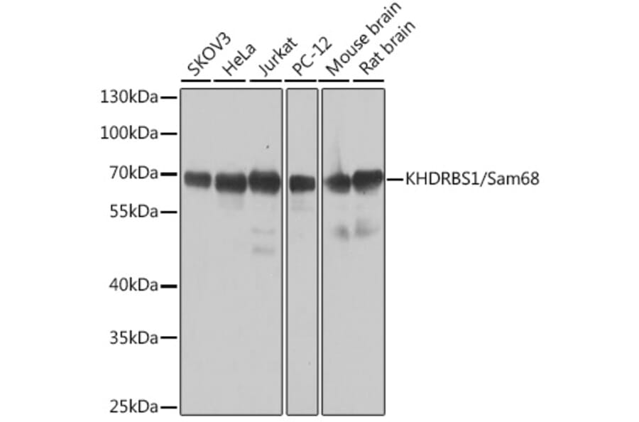 Western Blot - Anti-SAM68 Antibody (A15072) - Antibodies.com