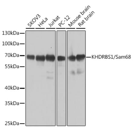 Western Blot - Anti-SAM68 Antibody (A15072) - Antibodies.com