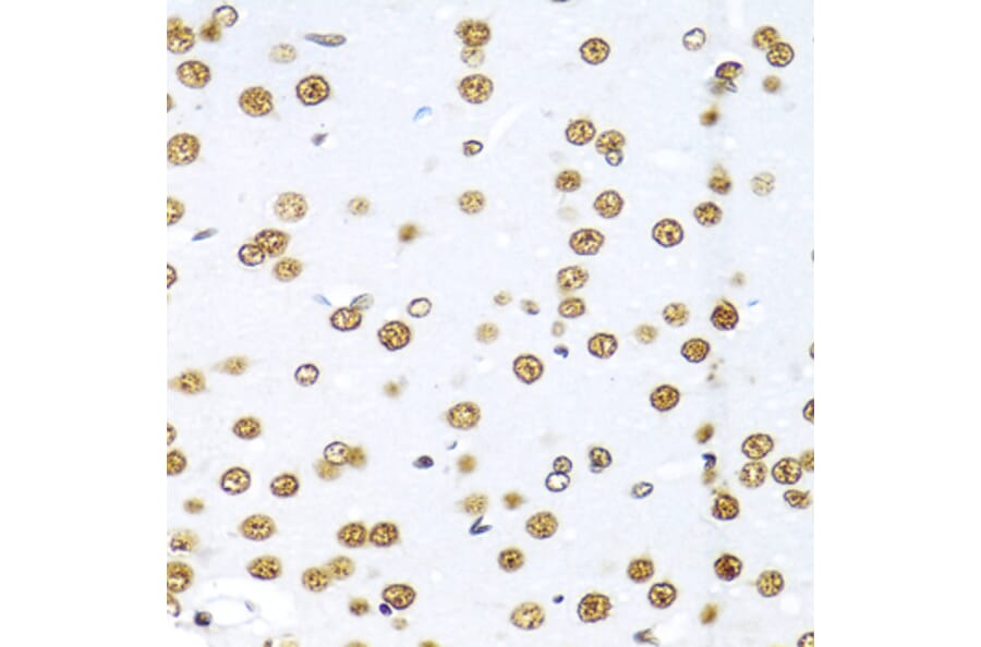 Immunohistochemistry - Anti-SAM68 Antibody (A15072) - Antibodies.com