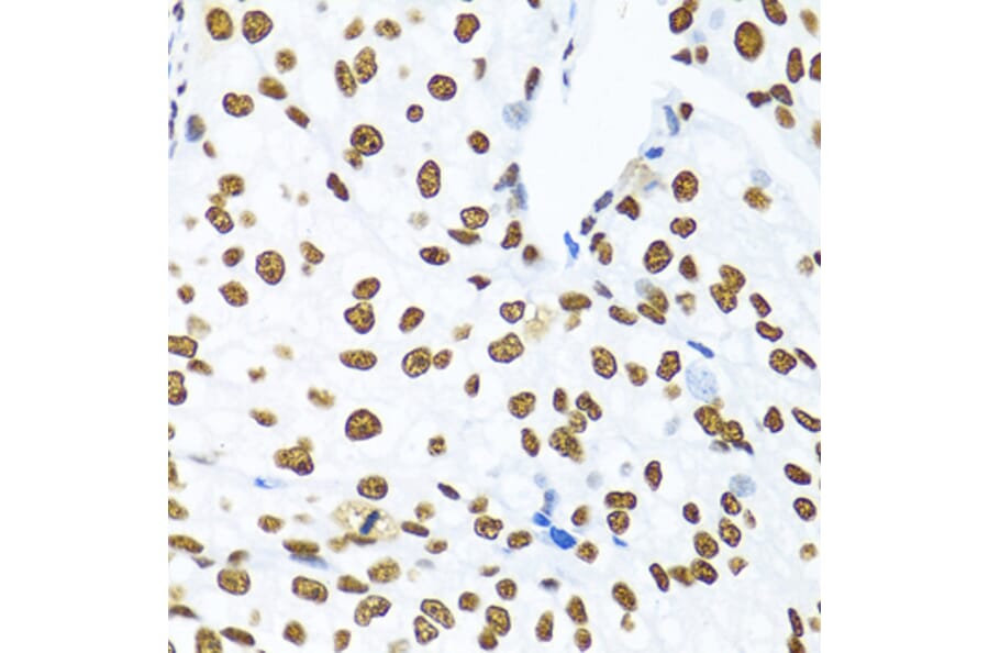 Immunohistochemistry - Anti-SAM68 Antibody (A15072) - Antibodies.com