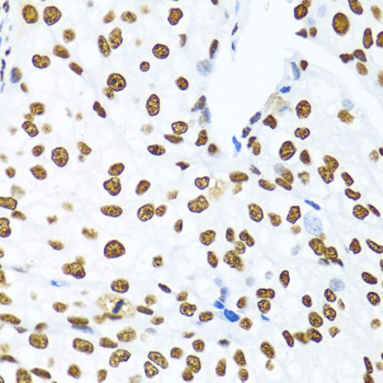 Immunohistochemistry - Anti-SAM68 Antibody (A15072) - Antibodies.com