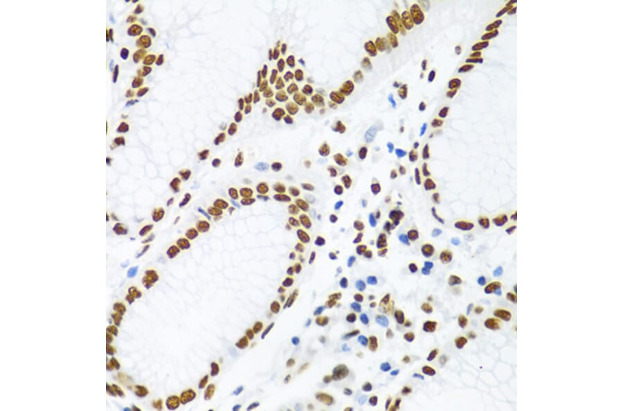 Immunohistochemistry - Anti-SAM68 Antibody (A15072) - Antibodies.com