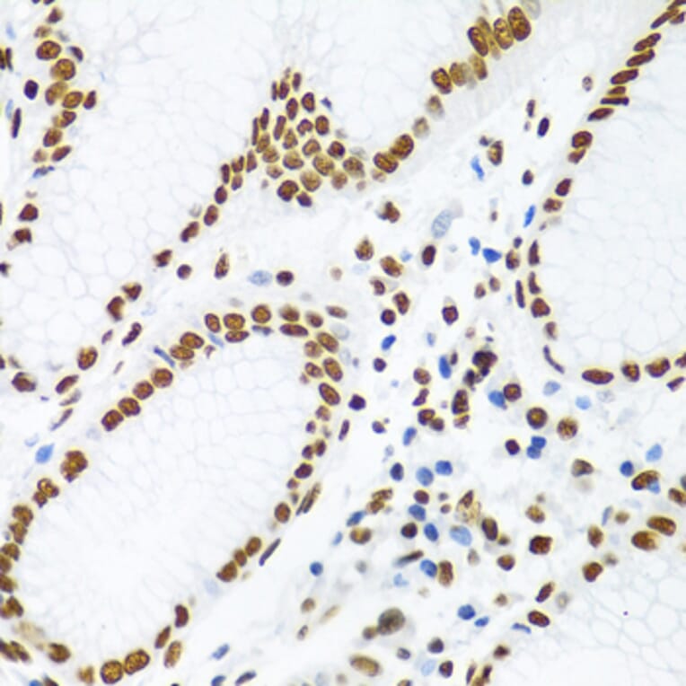 Immunohistochemistry - Anti-SAM68 Antibody (A15072) - Antibodies.com