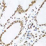 Immunohistochemistry - Anti-SAM68 Antibody (A15072) - Antibodies.com