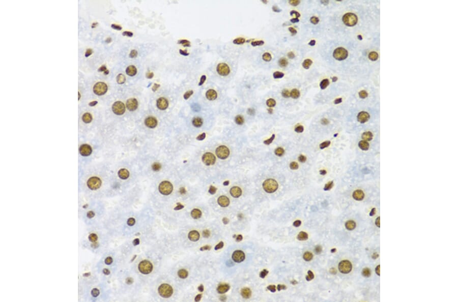 Immunohistochemistry - Anti-SAM68 Antibody (A15072) - Antibodies.com