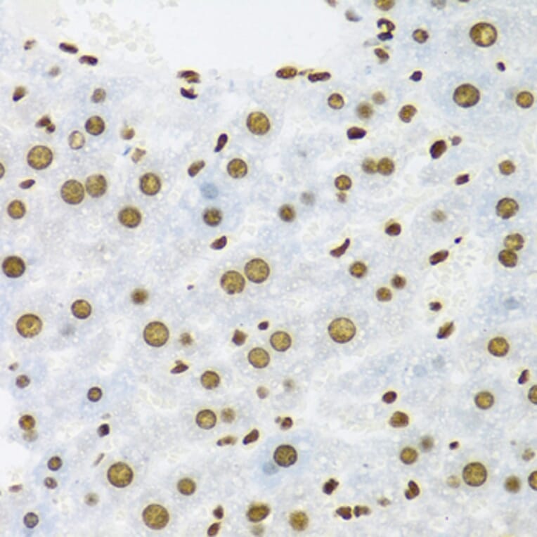 Immunohistochemistry - Anti-SAM68 Antibody (A15072) - Antibodies.com