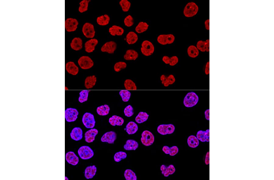 Immunofluorescence - Anti-SAM68 Antibody (A15072) - Antibodies.com