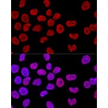 Immunofluorescence - Anti-SAM68 Antibody (A15072) - Antibodies.com