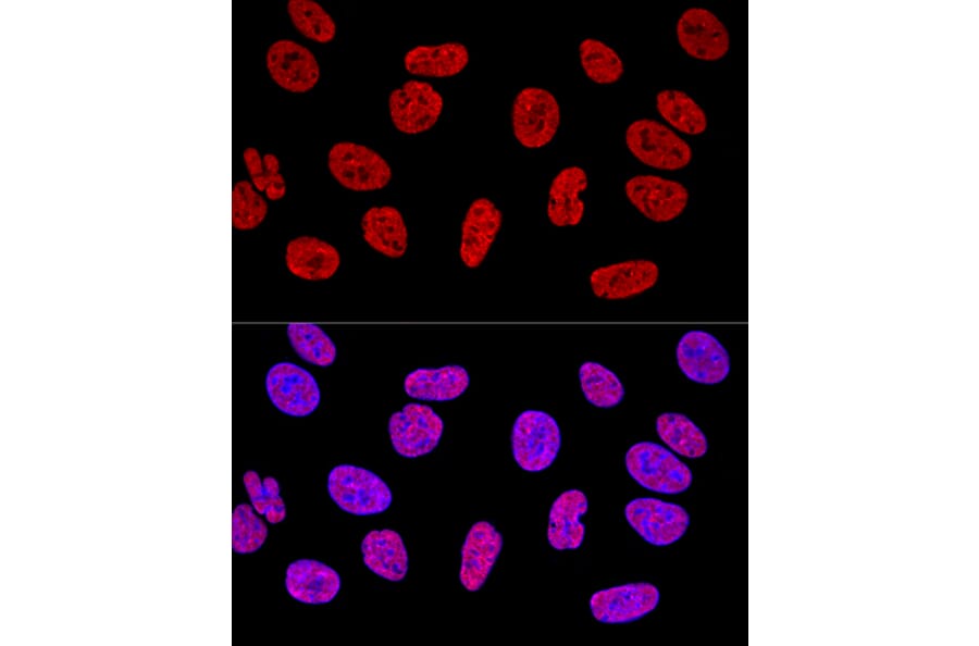 Immunofluorescence - Anti-SAM68 Antibody (A15072) - Antibodies.com