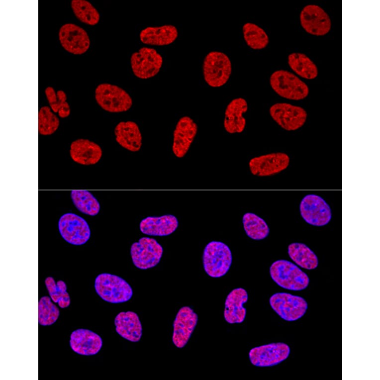 Immunofluorescence - Anti-SAM68 Antibody (A15072) - Antibodies.com