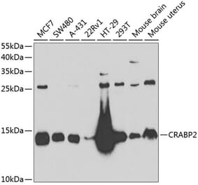 Western Blot - Anti-CRABP2 Antibody (A15073) - Antibodies.com