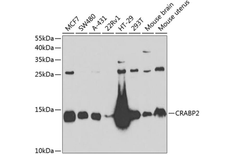 Western Blot - Anti-CRABP2 Antibody (A15073) - Antibodies.com