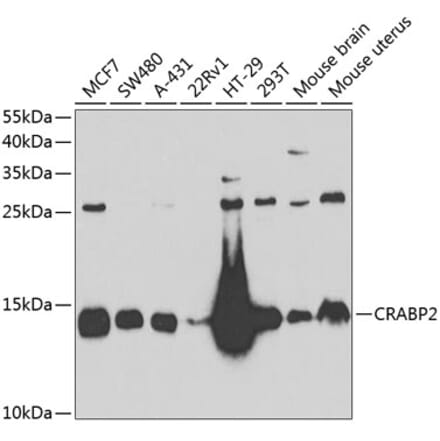 Western Blot - Anti-CRABP2 Antibody (A15073) - Antibodies.com