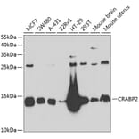 Western Blot - Anti-CRABP2 Antibody (A15073) - Antibodies.com