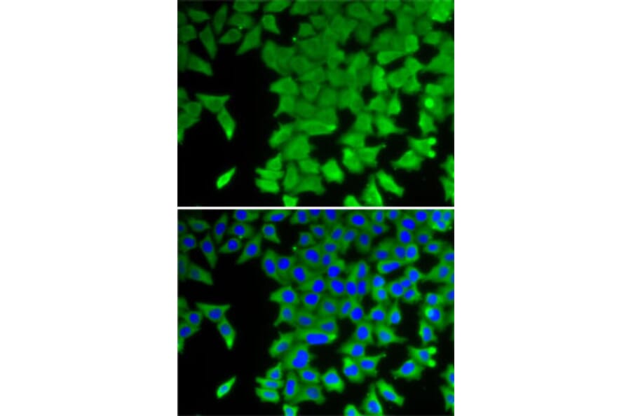 Immunofluorescence - Anti-CRABP2 Antibody (A15073) - Antibodies.com