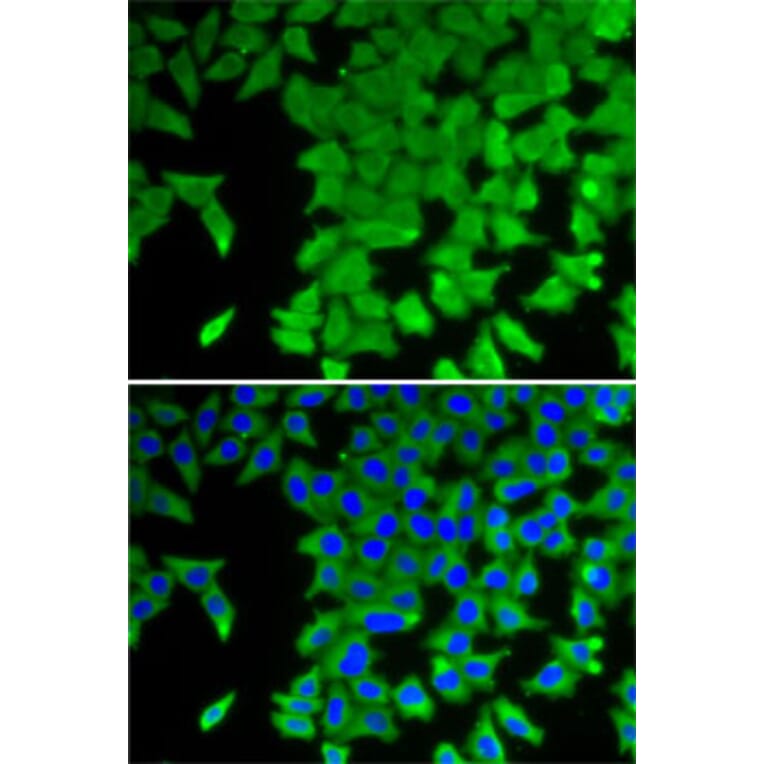 Immunofluorescence - Anti-CRABP2 Antibody (A15073) - Antibodies.com