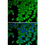 Immunofluorescence - Anti-CRABP2 Antibody (A15073) - Antibodies.com