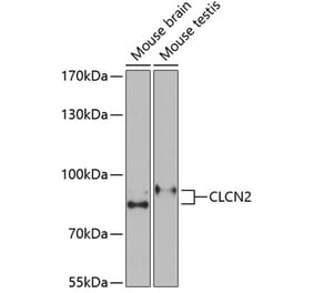 Western Blot - Anti-ClC-2 Antibody (A15074) - Antibodies.com