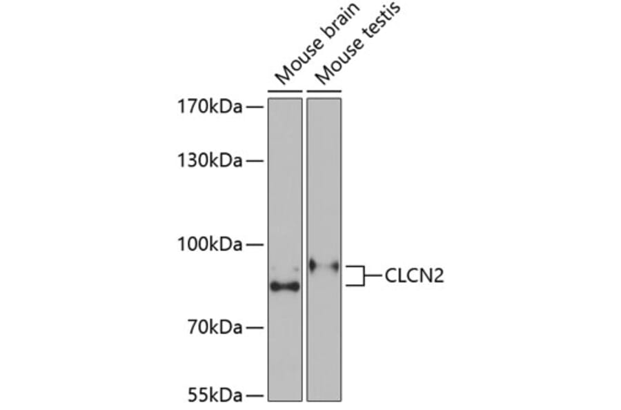 Western Blot - Anti-ClC-2 Antibody (A15074) - Antibodies.com