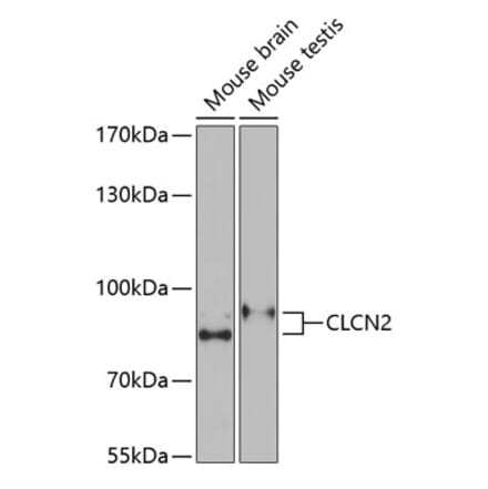 Western Blot - Anti-ClC-2 Antibody (A15074) - Antibodies.com