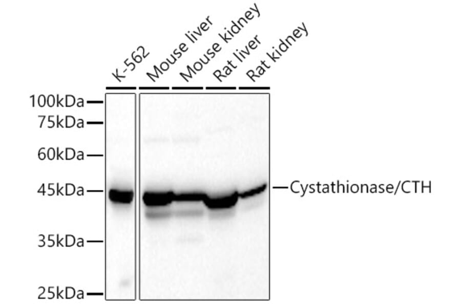 Western Blot - Anti-Cystathionase/CTH Antibody (A15075) - Antibodies.com