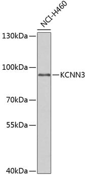 Western blot analysis of extracts of NCI-H460 cells, using Anti-KCNN3 Antibody (A6125) at 1:1,000 dilution.
Secondary antibody: Goat Anti-Rabbit IgG (H+L) (HRP) (AS014) at 1:10,000 dilution.
Lysates / proteins: 25µg per lane.
Blocking buffer: 3% non-fat dry milk in TBST.
Detection: ECL Enhanced Kit (RM00021).
Exposure time: 60s.